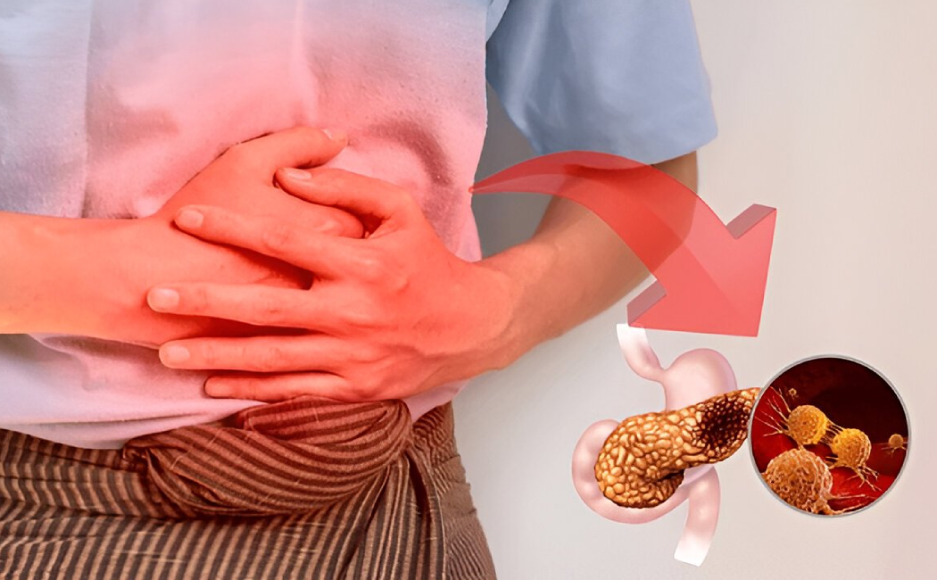 Is Your Stomach Healthy? – Gallstones
